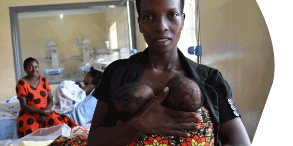 mother breastfeeding here twin babies