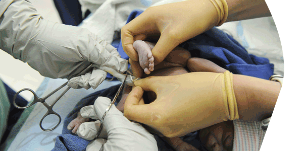 clamping the umbilical cord